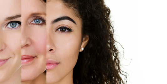 Skincare 101: How to determine your skin type?